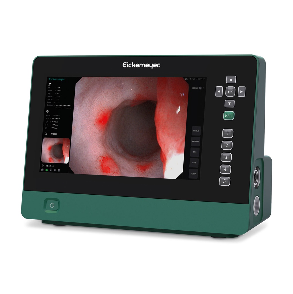 System endoskopowy EickView 5 w 1